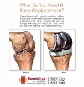 Joint Replacement Surgeon in Satellite, knee Replacement Hospital in Satellite, Joint Replacement Surgery Doctors in Satellite