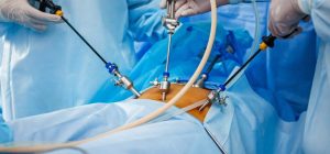 Laparoscopic Surgeon in Bodakdev, Laparoscopic Doctor in Bodakdev, Laparoscopy Doctors in Bodakdev