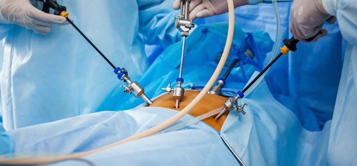 Laparoscopic Surgeon